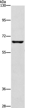 CDC25B  Antibody