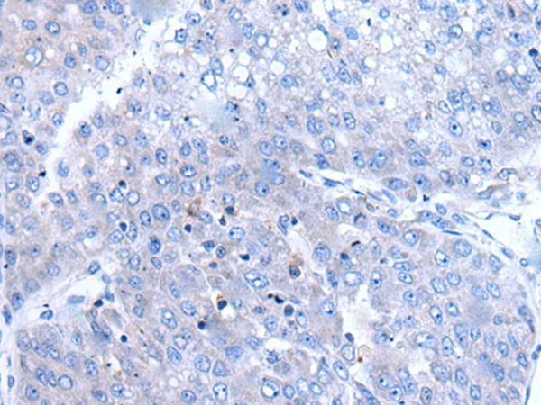 BTG4 Antibody