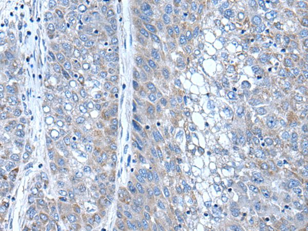 SFRP4 Antibody