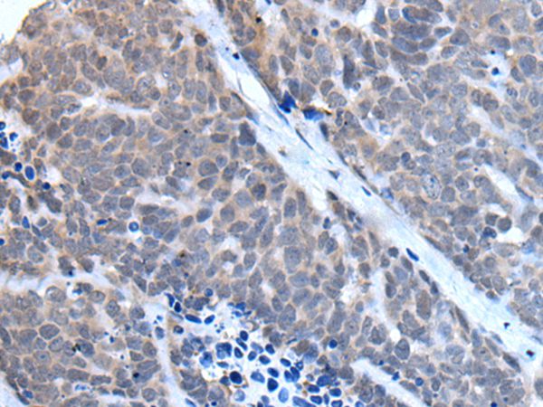 TBX6 Antibody