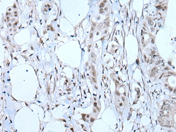 TBX6 Antibody