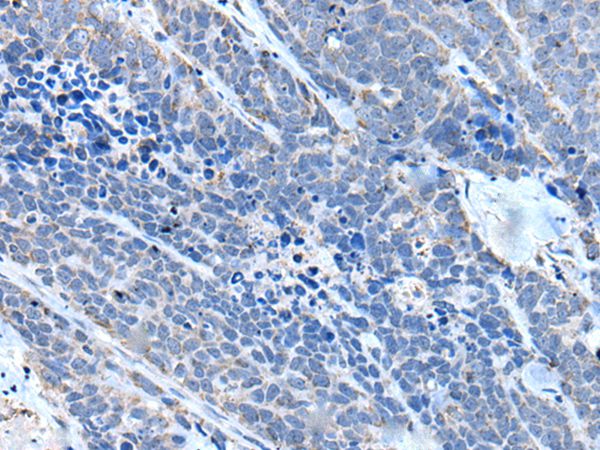 ITGA4 Antibody