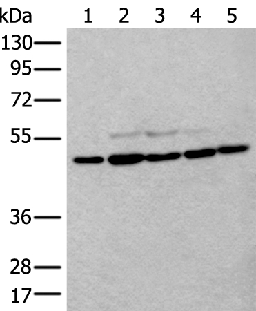 TUBB Antibody