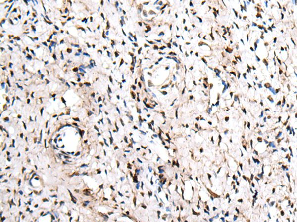 ZNF207 Antibody