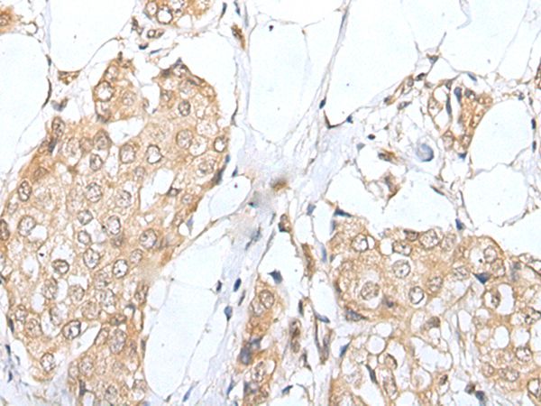 ZNF263 Antibody