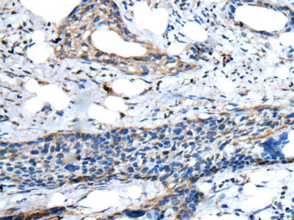 ZNF277 Antibody