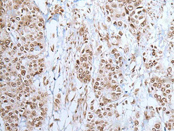 ZNF302 Antibody