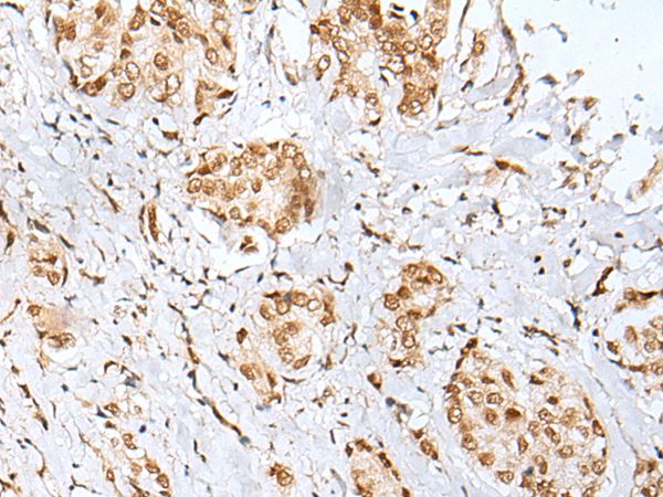 ZNF354A Antibody