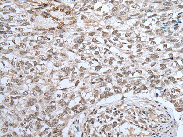 ZNF37A Antibody