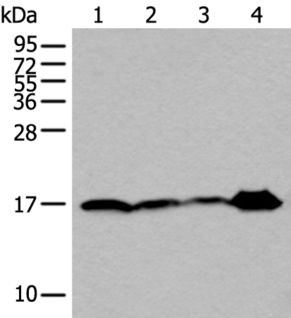 UBE2V2 Antibody