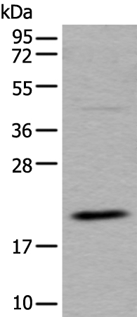 UFC1 Antibody