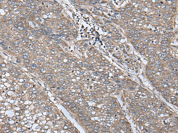 UQCRQ Antibody