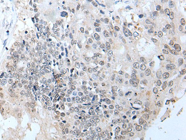 SLC5A10 Antibody