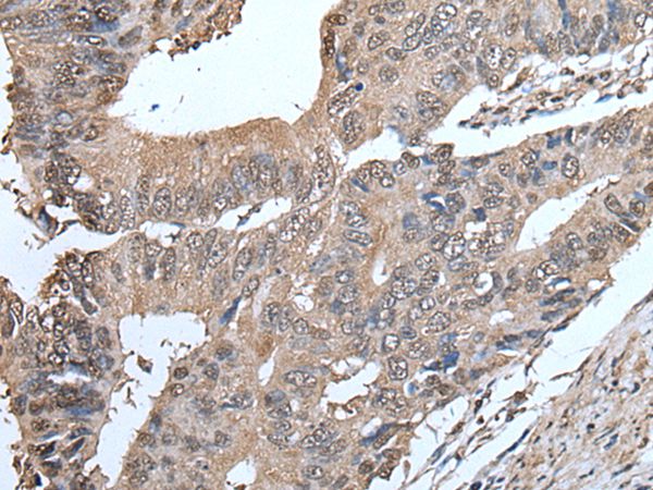 SMC5 Antibody