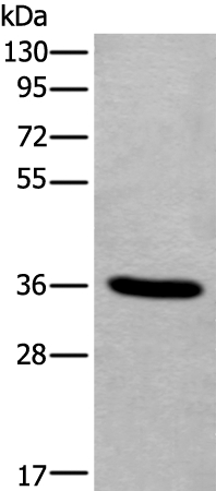 TNMD Antibody