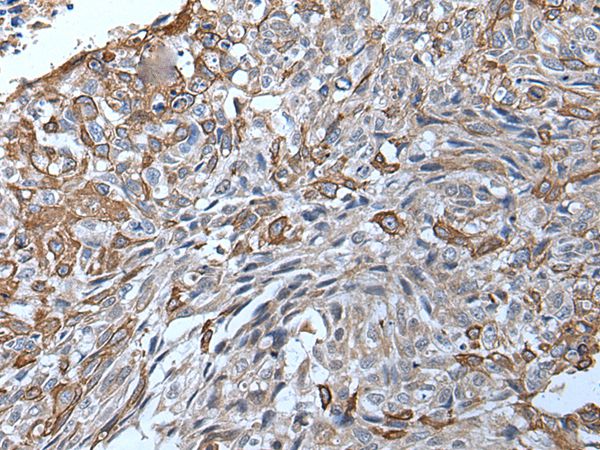 TRPC5 Antibody