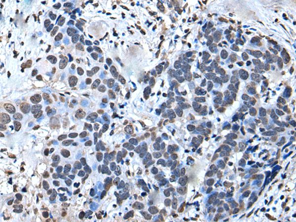 GTF2H1 Antibody