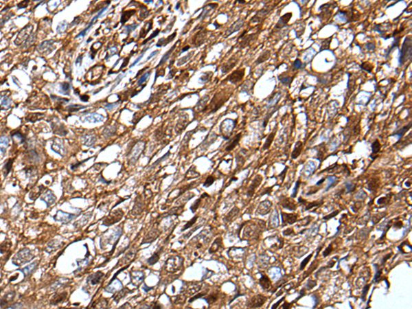 MLXIPL Antibody