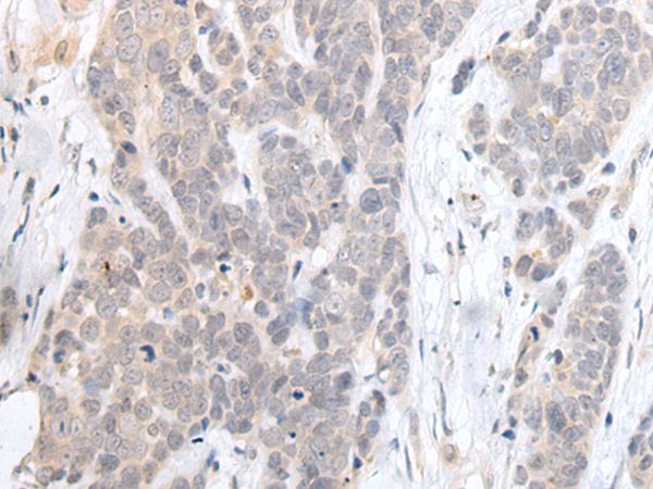 HDAC4 Antibody