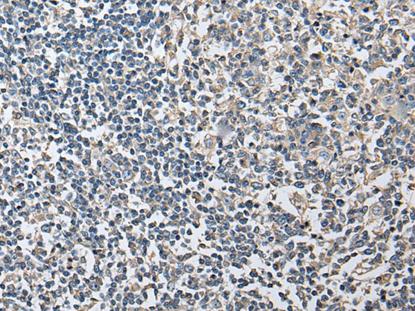 PLA2G16 Antibody