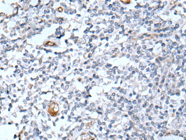 DLK2 Antibody