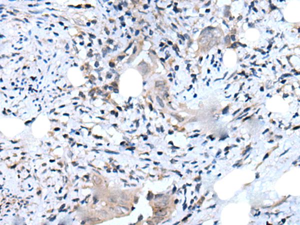 DLK2 Antibody