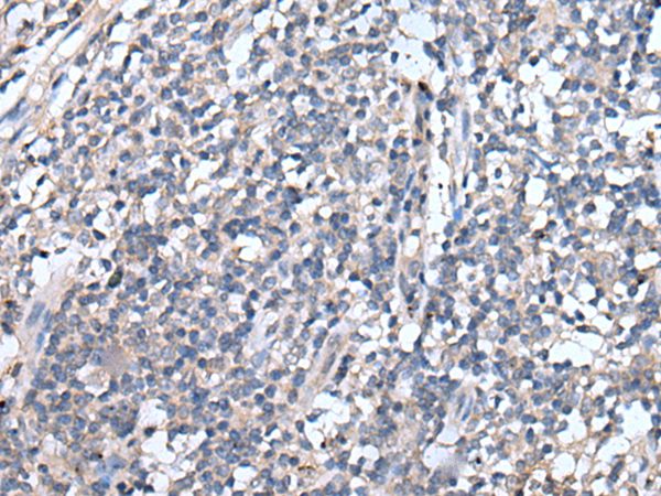 EMP1 Antibody