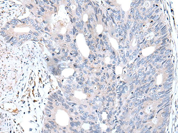 FABP12 Antibody