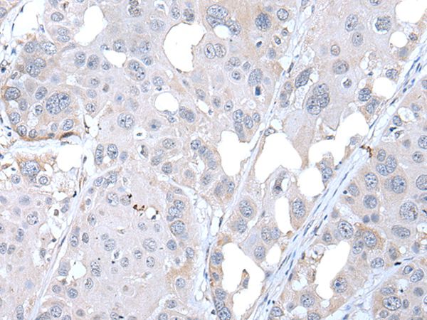 FABP12 Antibody