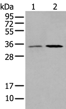 HOXB5 Antibody