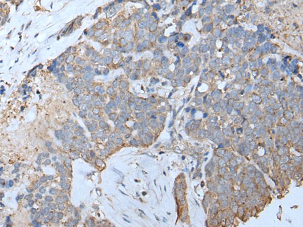 IFITM1 Antibody