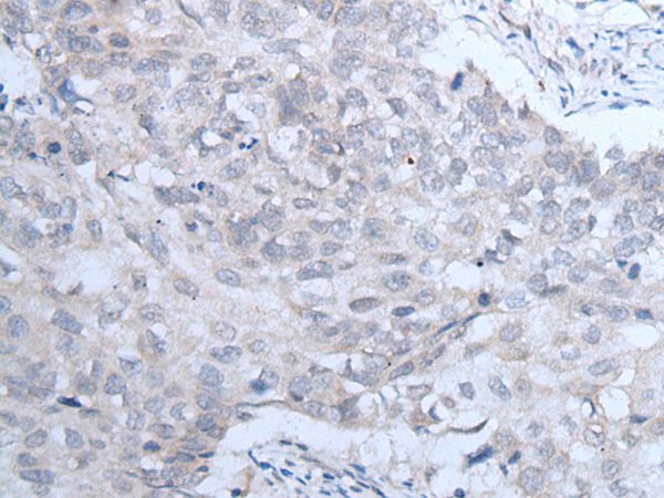 IGF1R Antibody