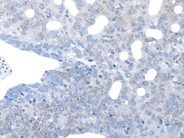 IGSF11 Antibody