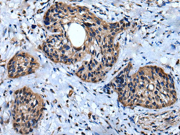 IQGAP1 Antibody