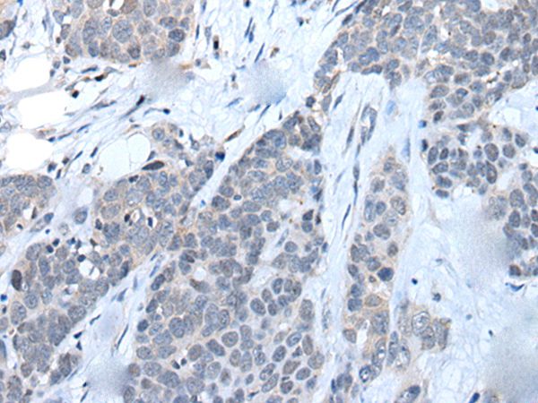 LILRB5 Antibody