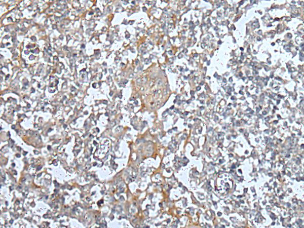 KIF14 Antibody