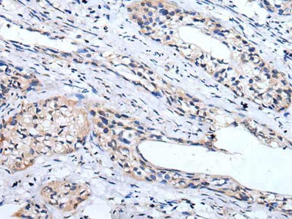 LINGO1 Antibody