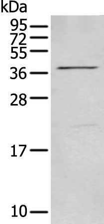 MAGEB18 Antibody