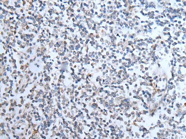 TMPRSS6 Antibody