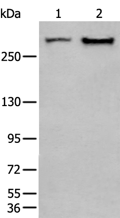 SPTA1 Antibody