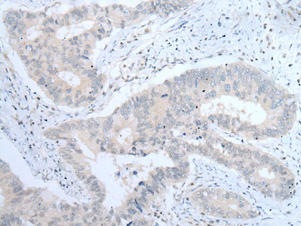 ITGA8 Antibody