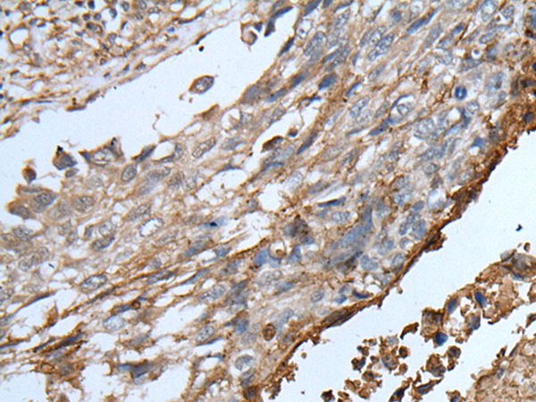 KLRK1 Antibody