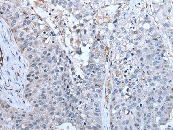 ZC3HAV1 Antibody