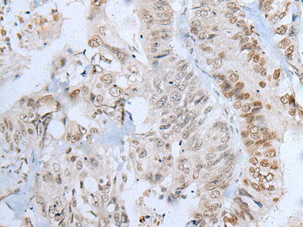 ZNF143  Antibody