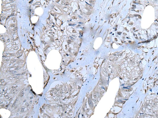 ZNF703 Antibody