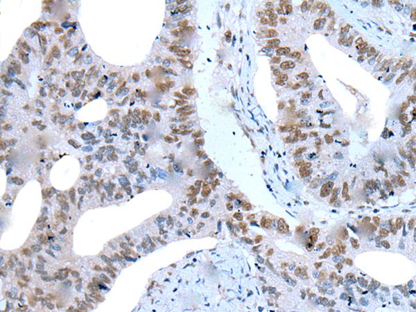 ZNF76 Antibody