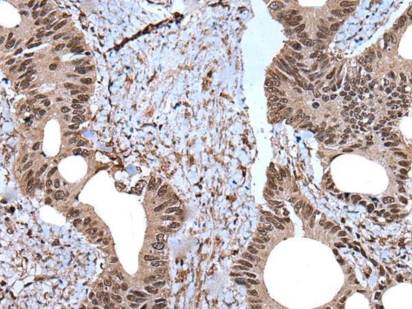 ZNF787 Antibody