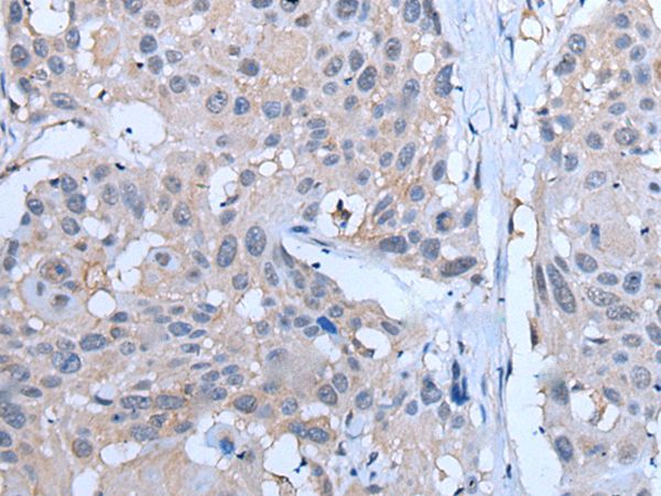 YPEL5 Antibody