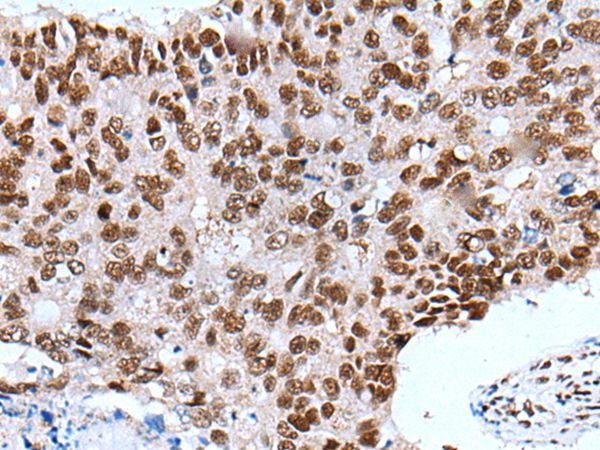 XAB2 Antibody