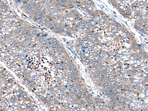 XIRP1 Antibody